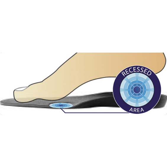 DonJoy Arch Rival Orthotic Size A,B,C,D,E,F,G OrthoBracing