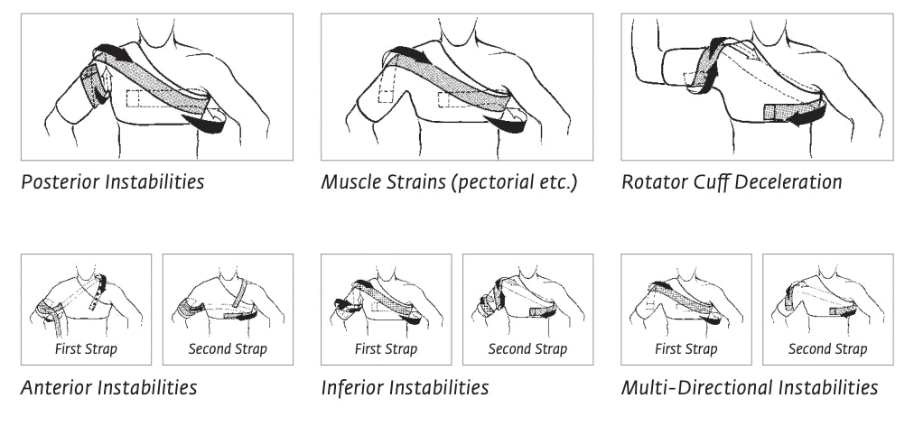 Shoulder Pain: Common Causes & How to Properly Treat It