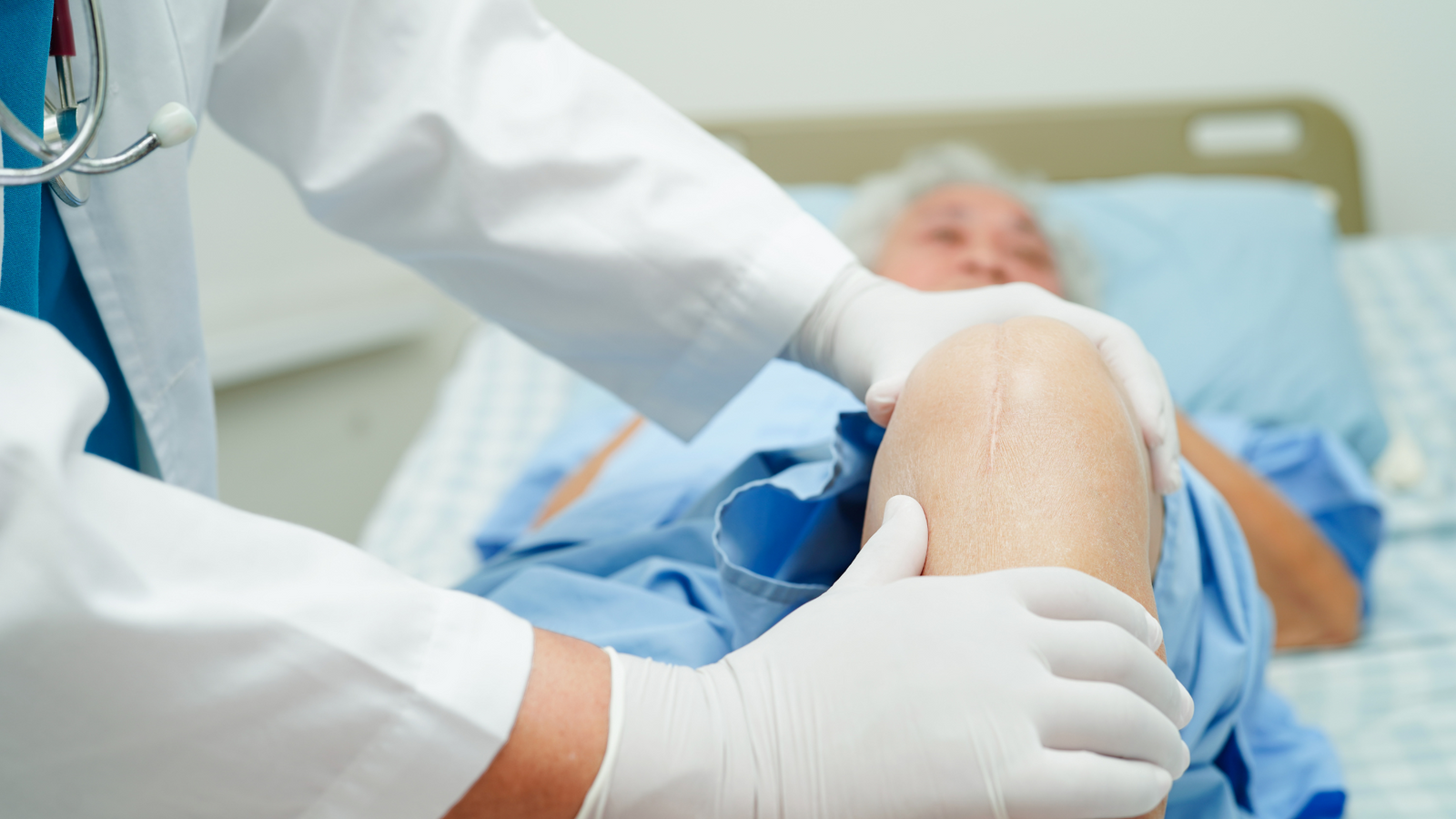 What Is A Partial Knee Replacement?